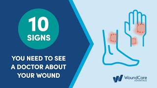 10 Signs you need to see a doctor for Wound Care [upl. by Acebber]