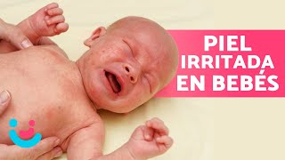 ¿Cómo CURAR un SARPULLIDO a mi BEBÉ 🤱🏻🧼 Remedios Caseros [upl. by Maryly]