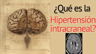 Hipertensión Intracraneal Perlas [upl. by Itsirhc]