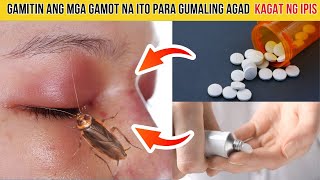 TOP 5 na EFFECTIVE na GAMOT para sa KAGAT NG IPIS [upl. by Azne901]