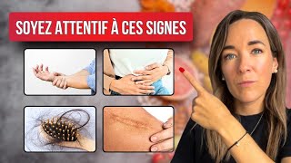 Ces 9 Signes Alarmants Révèlent Que Vous Manquez CRUELLEMENT de Protéines  ⚠️❗ [upl. by Helbonnas104]