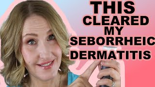 HOW I CLEARED UP MY SEBORRHEIC DERMATITIS [upl. by Latouche]