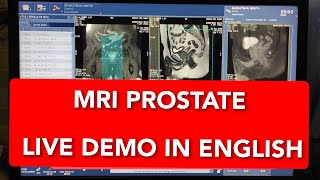 Prostate MRI scan protocol positioning and planning  Live Demo in English [upl. by Lienhard]