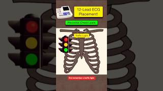 12 Lead ECG placement ECG leads kaise lagay ecg biology shorts youtubeshorts youtube [upl. by Adamsun]