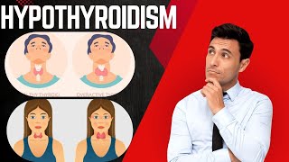 “hypothyroidism” ⚠️alert⚠️ “hypothyroidism” reviews [upl. by Enahpad]