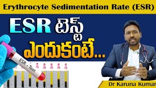 ESR  Erythrocyte Sedimentation Rate  High ESR causes  Dr Karuna Kumar  Hematologist [upl. by Enayd649]