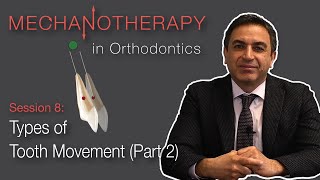 Mechanotherapy in Orthodontics Types of Tooth Movement Pt 2 [upl. by Nyladnohr]