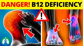 ⚠️ Top 10 DANGERS of Vitamin B12 Deficiency ▶ BEWARE ❗ [upl. by Nosreh329]