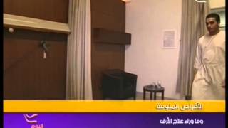 Sleep Medicine Department DrShadi Sharifi interview [upl. by Kerin]