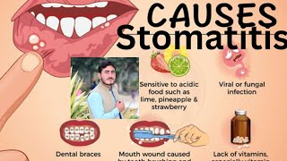 Stomatitis Chapter1 Disease1 AHN 3rd semester kmu slides in pashto drnajeebnote drnajeeb kmupdat [upl. by Lerrad]