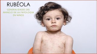 Rubéola en Niños  Etiología Diagnóstico Clínica y Tratamiento  Pediatría [upl. by Allyn]