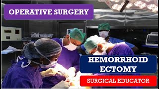 HEMORRHOIDECTOMYSTEP BY STEP OPERATIVE SURGERY [upl. by Edlyn438]