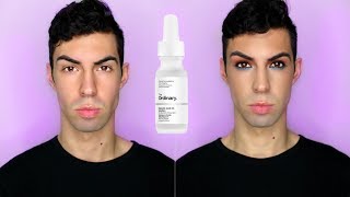 ACNE IS GONE 4 The Ordinary Salicylic Acid [upl. by Keenan]