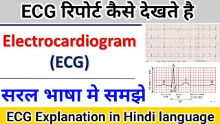 ECG report कैसे देखते है  Electrocardiogram explanation in hindi language [upl. by Aurelie863]