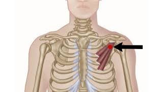 Pectoralis Minor  Trigger Point Therapy  Anatomy Tutorial [upl. by Consuelo329]