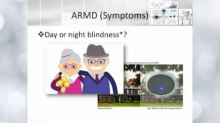 Elbromboly Basic ophthalmology IC Retina Retinal dystrophies and degeneration [upl. by Schou987]