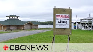 Mercury poisoning near Grassy Narrows First Nation worsened by ongoing industrial pollution study [upl. by Saffier]