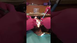 dentist drilling part 2 [upl. by Truda]