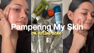 My Skincare Routine For Active Acne  How To Get Rid ofPimples Acne amp Blemishes skincareforacne [upl. by Skolnik]