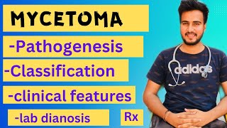 Mycetoma microbiology  Madura footeumycetomaActinomycetomalab diagnosis treatment [upl. by Omixam]