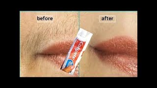 In 5 Minutes Remove Unwanted Hair  Effective Hair Removal [upl. by Salhcin]