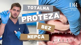 Kako Izgleda Proteza Bez Nepca  Na Drikere [upl. by Yerag]