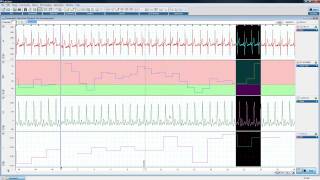 LabChart Mastery你不能不知道的LabChart功能 LabChart features you should know about [upl. by Kimon]