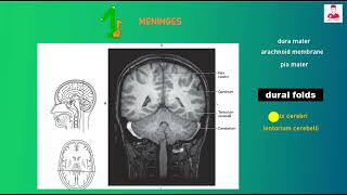 الجزء التالت 03 تشريح إشعاعي علي الدماغ  sectional anatomy of the brain  cisterns [upl. by Are178]