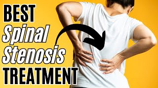 Best Spinal Stenosis Treatment [upl. by Yrellam745]