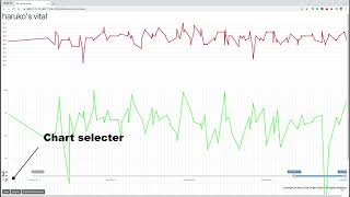 Homemade Vital Signs Chart 自家製バイタルグラフ。20220825 [upl. by Wilone]