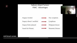 Salivary gland tumor  Dr Anil Dcruz sir [upl. by Fink]