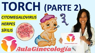 TORCH PARTE 2 CITOMEGALOVIRUS HERPES SÍFILIS Infecciones y embarazo Ginecología y Obstetricia [upl. by Ahseral80]