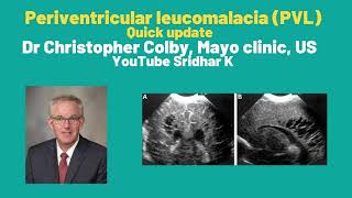 A quick overview of PVLperiventricular leucomalacia in preterm babies Dr Christopher Colby [upl. by Adnic20]