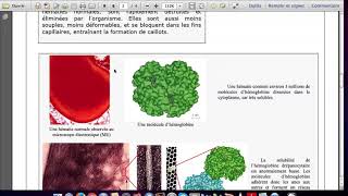 1ère Spé SVT Tp1Ch1 Etude dune maladie monogénique  La drépanocytose [upl. by Pelson]