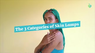 The 3 Categories of Skin Lumps [upl. by Neraj]