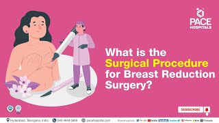 Breast Reduction Surgical Procedure  What is the surgical procedure for Breast Reduction Surgery [upl. by Nenad]