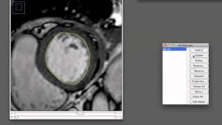 ImageJ Contour Drawing Procedure [upl. by Deehan927]