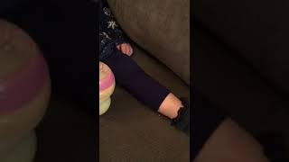 Hemiplegia paralysis age 2 April 2018 [upl. by Lipsey]