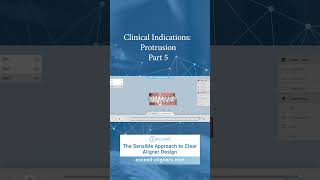 Clinical Indications Protrusion Part 5 [upl. by Enrev486]