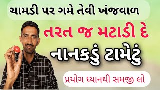 ચામડી પર ગમે તેવી ખંજવાળને એક નાનકડું ટામેટું આ રીતે મટાડી દે  ખંજવાળ નો ઈલાજ [upl. by Sousa709]