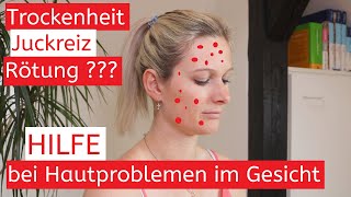 4K Rötung – Juckreiz – Trockenheit Das hilft bei Hautproblemen im Gesicht  Ursachen  Tipps [upl. by Waite]