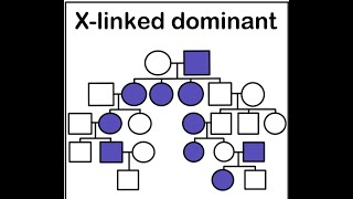 Pedigree Analysis of X linked dominant inheritance [upl. by Uos]