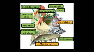 Fractura y cuerpos extraños en cavidad orbitaria [upl. by Kessler]