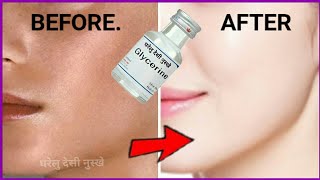 गिल्सरिन में ये मिलायेपाये गोरा चेहरा  whiteningFace glowingFace cleaning [upl. by Dis103]