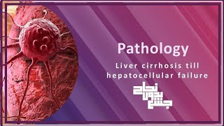 Liver cirrhosis till hepatocellular failure patho L3 [upl. by Steinke]