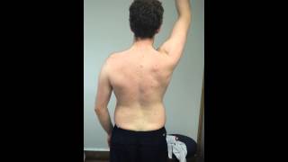 Cervical lateral glide with arm flexion [upl. by Burnight]