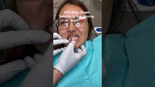 Missing tooth  Implant too pricey  Watch this Simple solution ❤️ [upl. by Anerac]