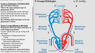 Pulmonary Hypertension Made Simple  USMLE Step 1COMLEX Review [upl. by Arvind]