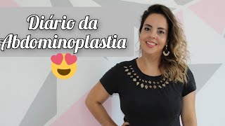 Abdominoplastia ❤️ PRIMEIRA CONSULTA COM VALORES ❤️ Cirurgia Plástica 1 [upl. by Kailey235]