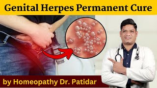 Genital Herpes Permanent Cure by Homeopathy Dr Sunil Patidar genitalherpes [upl. by Sorac]